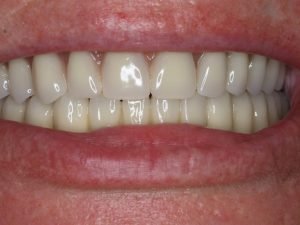 E323478F-DDD7-4E6E-80B2-A586C5FD7538 E323478F-DDD7-4E6E-80B2-A586C5FD7538